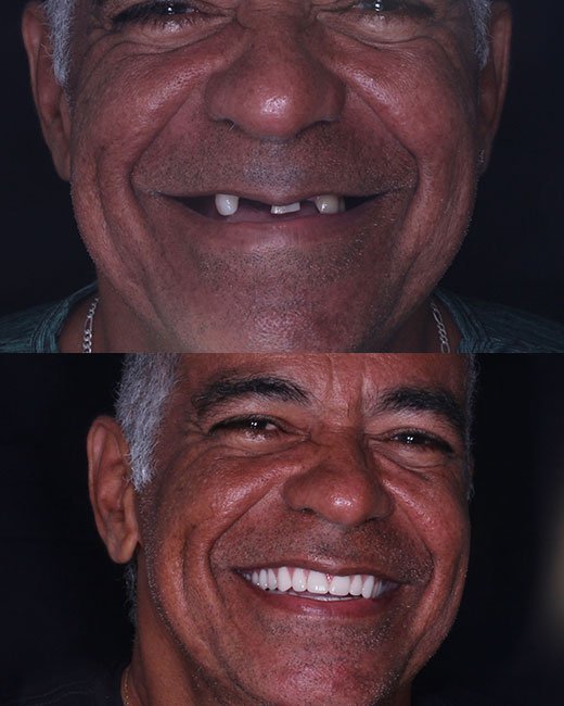 Casos-Antes-e-Depois1