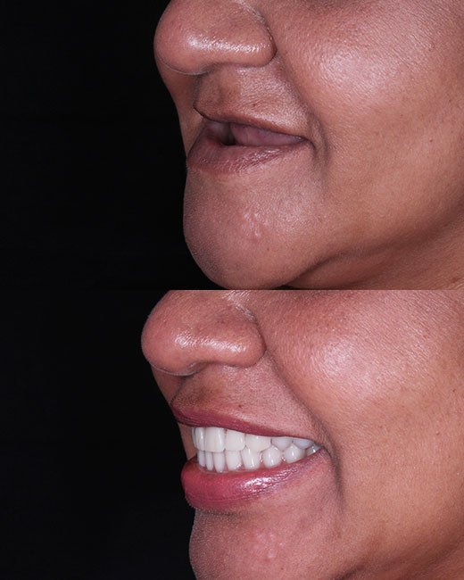 Casos-Antes-e-Depois2